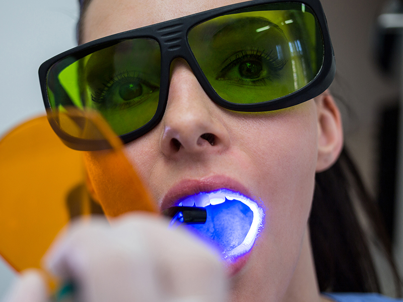 albire dentara stomatologie resita